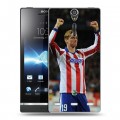 Дизайнерский пластиковый чехол для Sony Xperia S