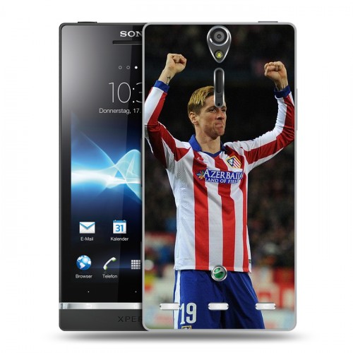 Дизайнерский пластиковый чехол для Sony Xperia S