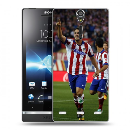 Дизайнерский пластиковый чехол для Sony Xperia S