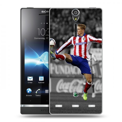 Дизайнерский пластиковый чехол для Sony Xperia S