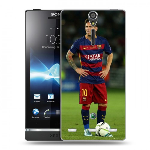 Дизайнерский пластиковый чехол для Sony Xperia S