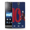 Дизайнерский пластиковый чехол для Sony Xperia S