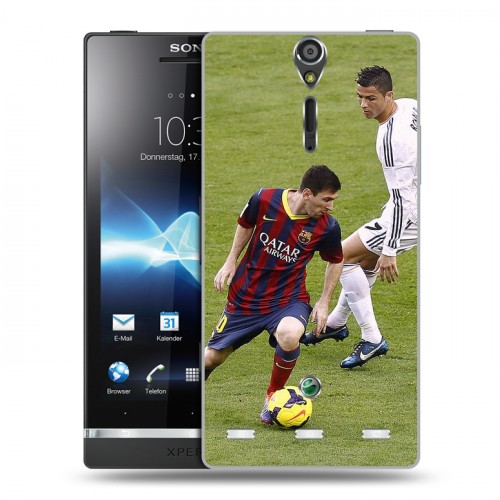 Дизайнерский пластиковый чехол для Sony Xperia S