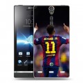 Дизайнерский пластиковый чехол для Sony Xperia S