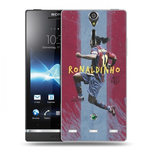 Дизайнерский пластиковый чехол для Sony Xperia S