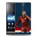 Дизайнерский пластиковый чехол для Sony Xperia S