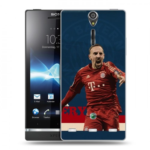 Дизайнерский пластиковый чехол для Sony Xperia S