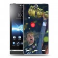 Дизайнерский пластиковый чехол для Sony Xperia S