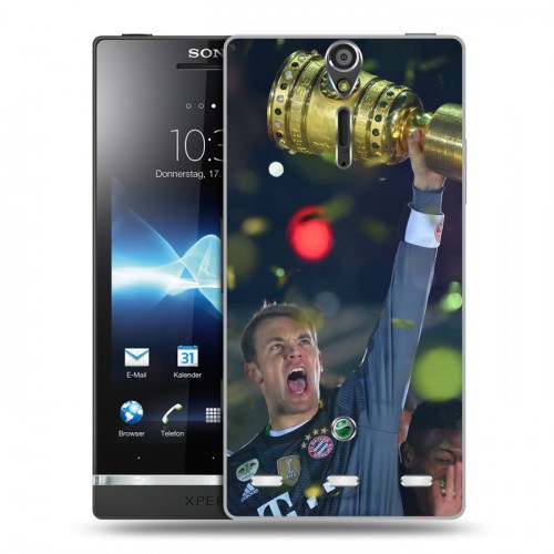 Дизайнерский пластиковый чехол для Sony Xperia S