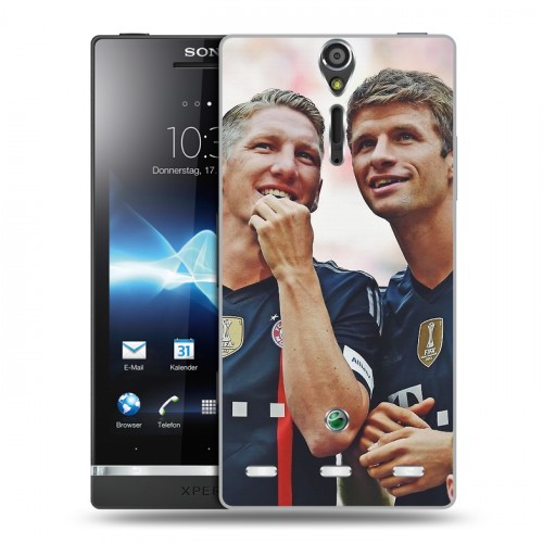 Дизайнерский пластиковый чехол для Sony Xperia S