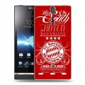 Дизайнерский пластиковый чехол для Sony Xperia S