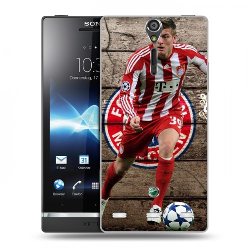 Дизайнерский пластиковый чехол для Sony Xperia S