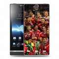 Дизайнерский пластиковый чехол для Sony Xperia S