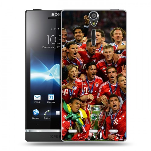 Дизайнерский пластиковый чехол для Sony Xperia S