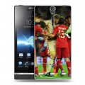 Дизайнерский пластиковый чехол для Sony Xperia S