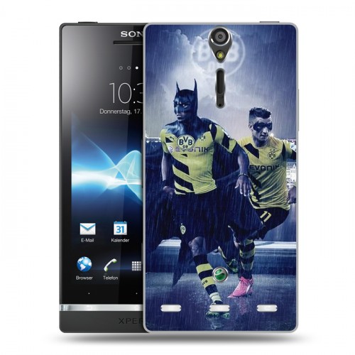 Дизайнерский пластиковый чехол для Sony Xperia S