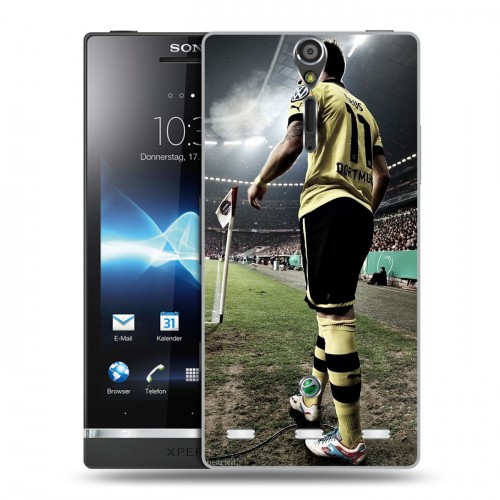 Дизайнерский пластиковый чехол для Sony Xperia S