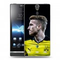 Дизайнерский пластиковый чехол для Sony Xperia S