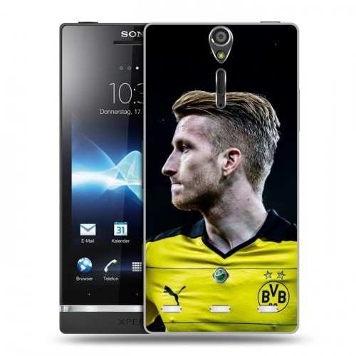 Дизайнерский пластиковый чехол для Sony Xperia S