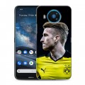 Дизайнерский силиконовый чехол для Nokia 8.3