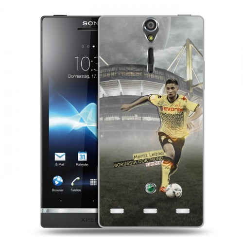 Дизайнерский пластиковый чехол для Sony Xperia S