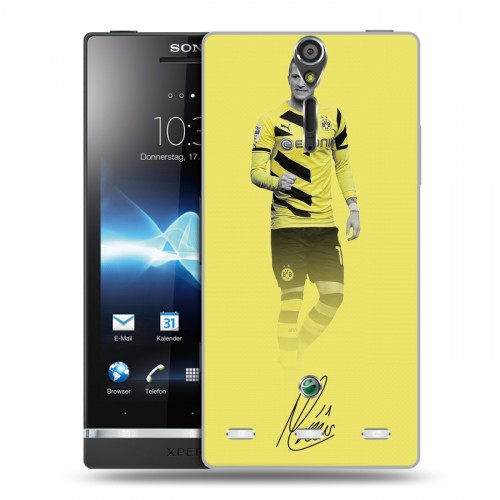 Дизайнерский пластиковый чехол для Sony Xperia S