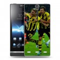 Дизайнерский пластиковый чехол для Sony Xperia S