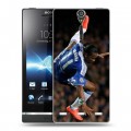 Дизайнерский пластиковый чехол для Sony Xperia S