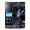 Дизайнерский пластиковый чехол для Sony Xperia S