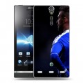 Дизайнерский пластиковый чехол для Sony Xperia S