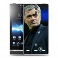 Дизайнерский пластиковый чехол для Sony Xperia S