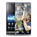 Дизайнерский пластиковый чехол для Sony Xperia S