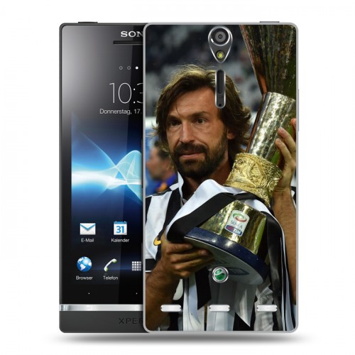 Дизайнерский пластиковый чехол для Sony Xperia S