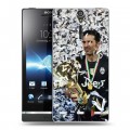 Дизайнерский пластиковый чехол для Sony Xperia S