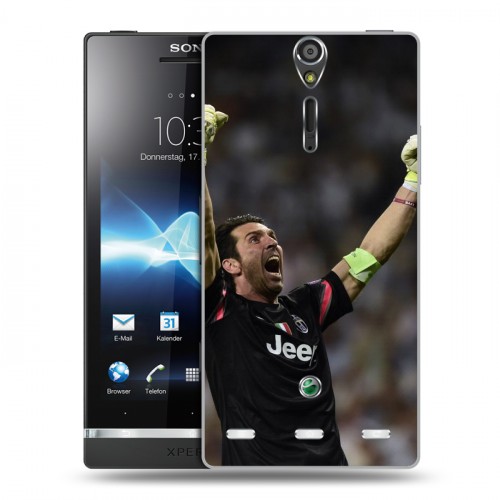 Дизайнерский пластиковый чехол для Sony Xperia S