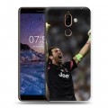 Дизайнерский пластиковый чехол для Nokia 7 Plus