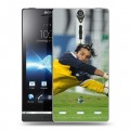 Дизайнерский пластиковый чехол для Sony Xperia S