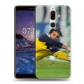 Дизайнерский пластиковый чехол для Nokia 7 Plus