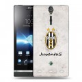 Дизайнерский пластиковый чехол для Sony Xperia S