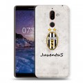 Дизайнерский пластиковый чехол для Nokia 7 Plus