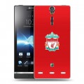 Дизайнерский пластиковый чехол для Sony Xperia S