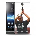 Дизайнерский пластиковый чехол для Sony Xperia S