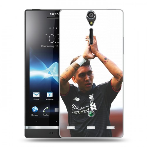 Дизайнерский пластиковый чехол для Sony Xperia S