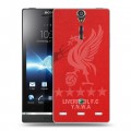 Дизайнерский пластиковый чехол для Sony Xperia S