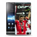 Дизайнерский пластиковый чехол для Sony Xperia S