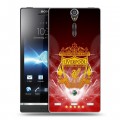 Дизайнерский пластиковый чехол для Sony Xperia S