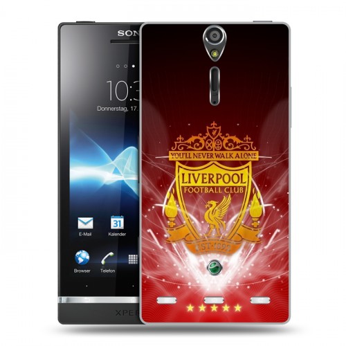 Дизайнерский пластиковый чехол для Sony Xperia S