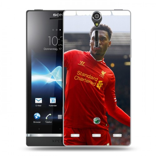 Дизайнерский пластиковый чехол для Sony Xperia S