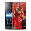 Дизайнерский пластиковый чехол для Sony Xperia S