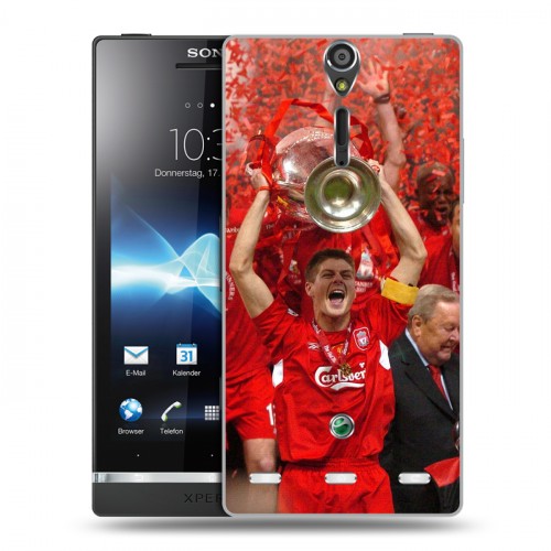 Дизайнерский пластиковый чехол для Sony Xperia S